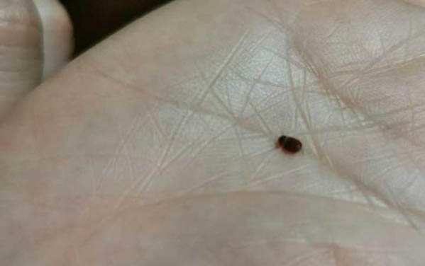 貓咪抓撓脖子有結痂是怎么回事兒