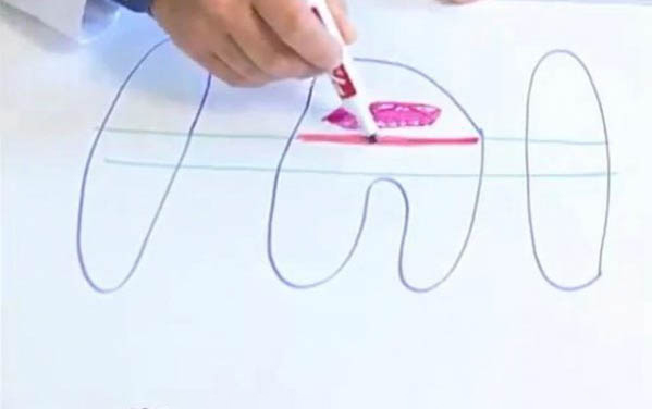 貓咪急性腎衰竭如何治療